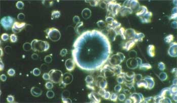 „Aspergillus"Pilzlinie