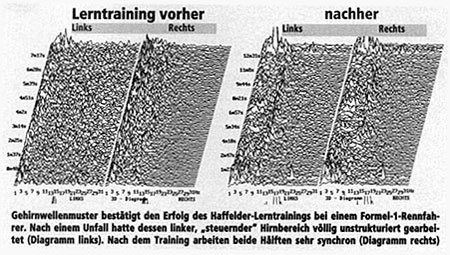 Gehirnwellenmuster