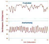 Herzrhythmus