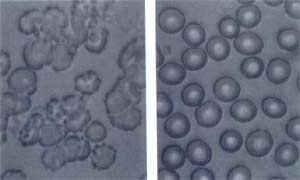 Dark-field microscopy