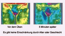 Thermografie